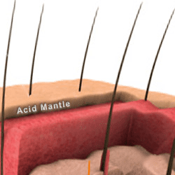 acid mantle