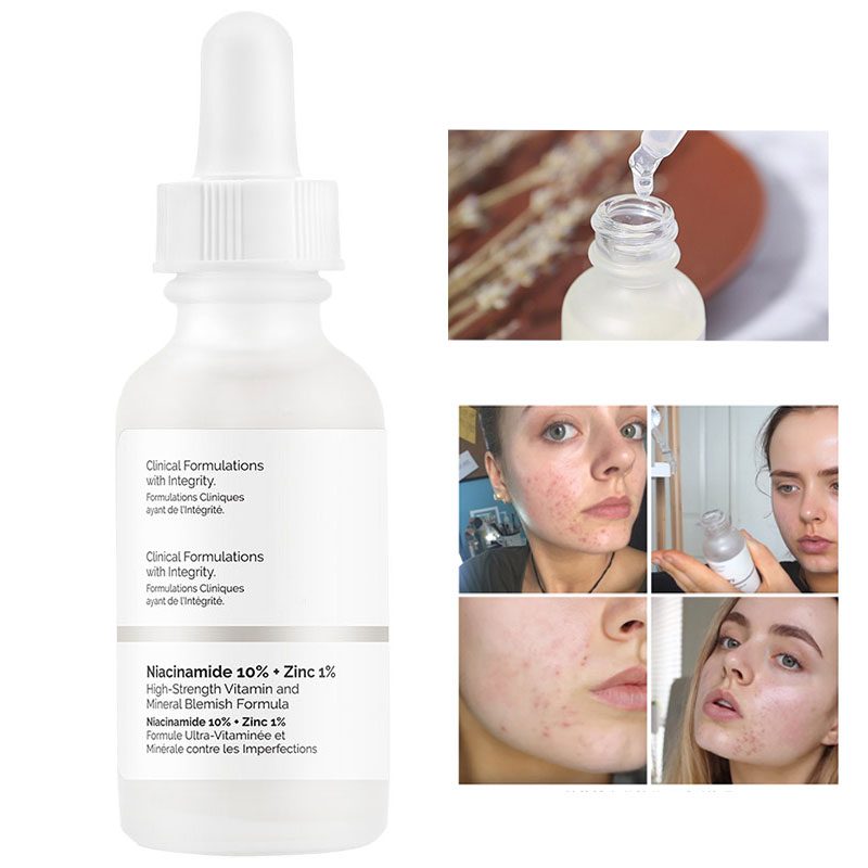 serum theordinary niacinamide orchard.vn